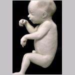 Humant embryo